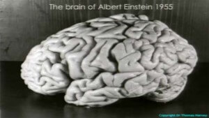 creierul-lui-albert-einstein